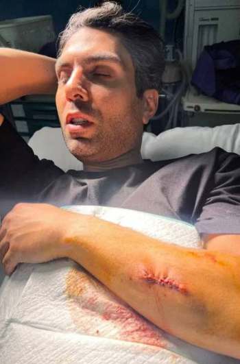 حمله سارقان به هافبک اسبق پرسپوليس