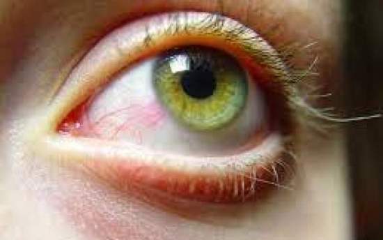 ممکن است داروها عامل خشکی چشم باشند؟