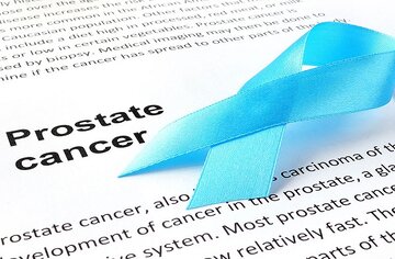 عوامل کاهش خطر ابتلا به سرطان مردان