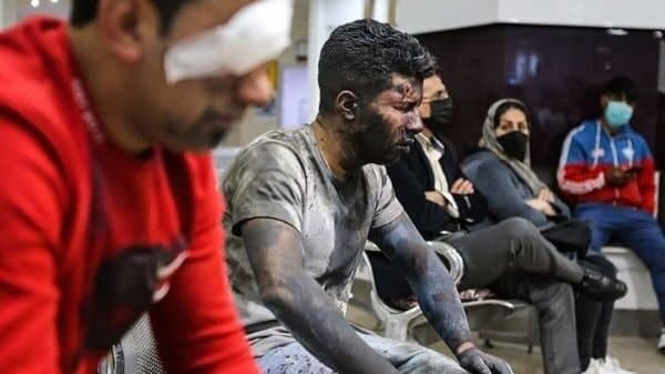  ۳۴۷ نفر مصدوم و ۱۵ نفر قطع عضو شدند