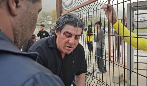 حمله خونین به آبادانی‌ها در نوشهر/عکس